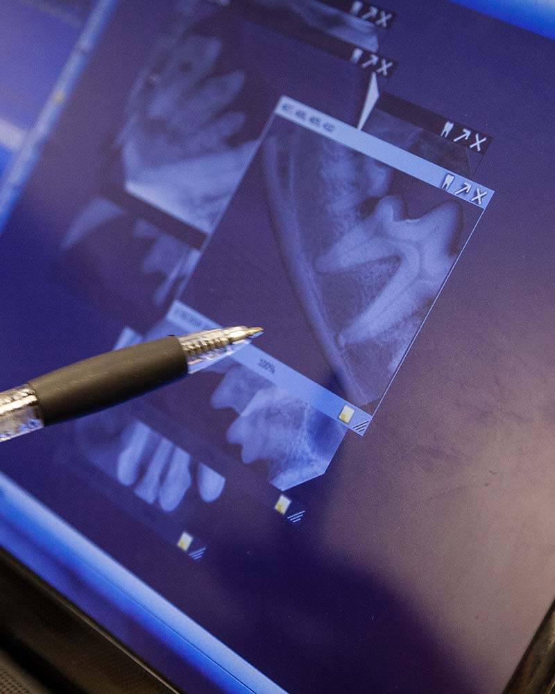 Dental Imaging